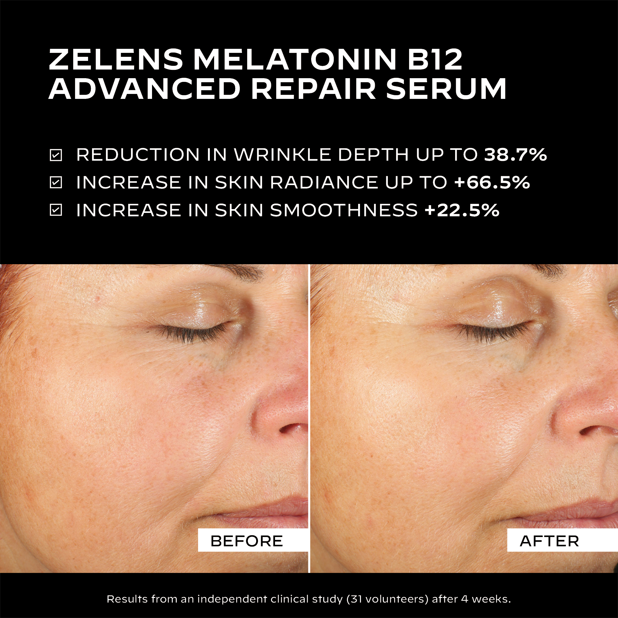 Melatonin B12 - Advanced Repair Serum